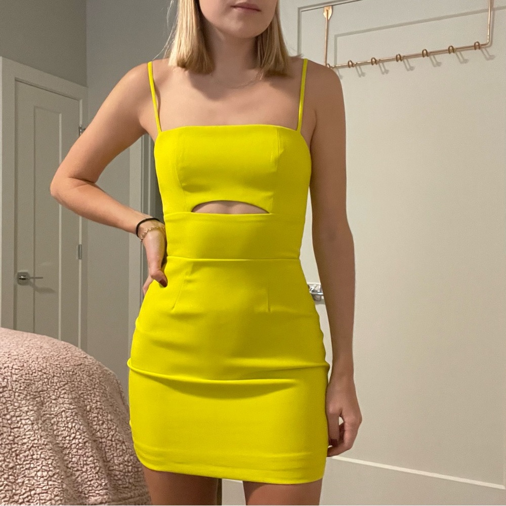 Superdown Yellow Mini Dress